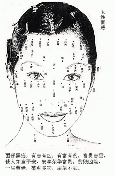 额头有痣的女人容易离婚吗？导致婚姻不顺的痣长在哪里？_女人额头有痣好不好,第2张